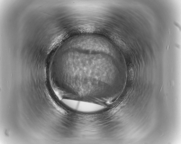 X0000093730638200710301045