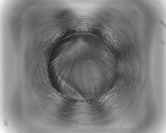 X0000093731297200710301036