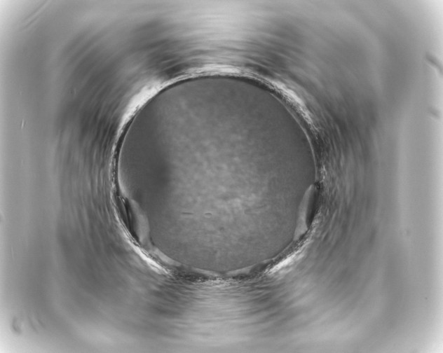 X0000093731373200710301036