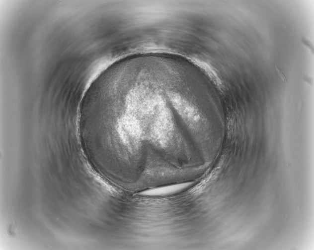 X0000093731374200710301036