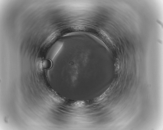 X0000093740124200710301112