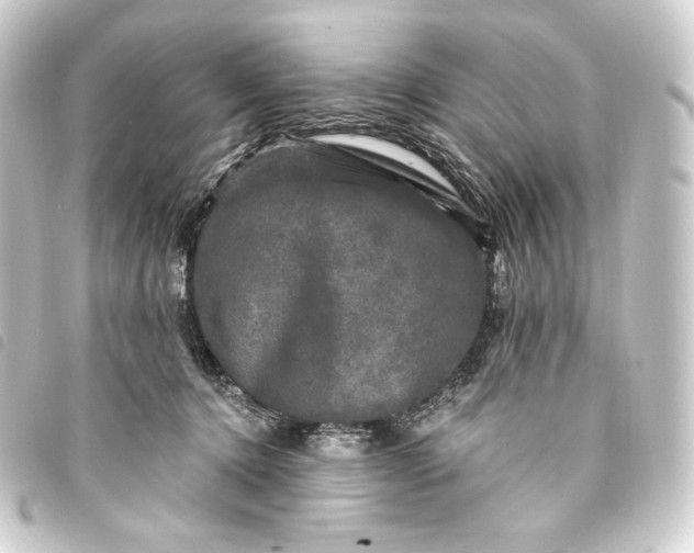 X0000093740368200710301110