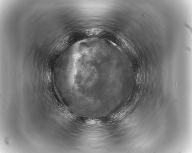 X0000093740561200710301107