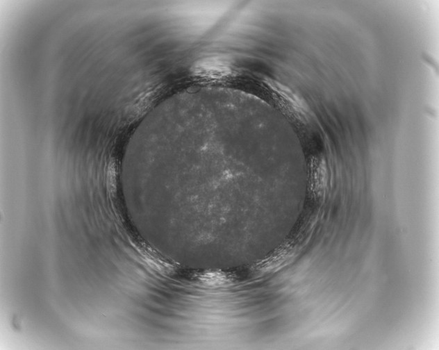 X0000093740562200710301107