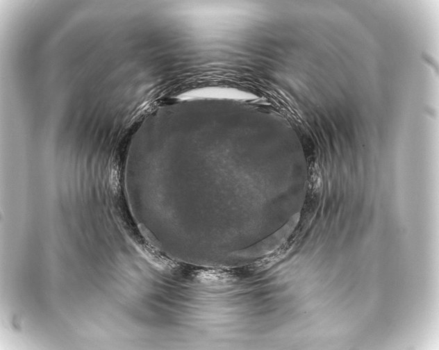 X0000093740568200710301107