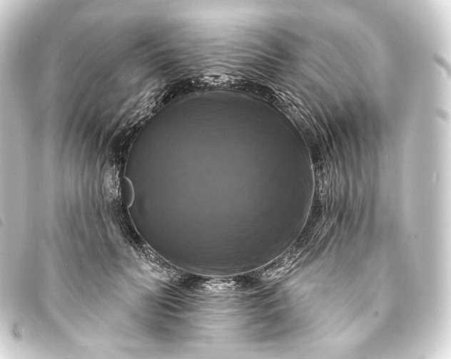 X0000093740606200710301106