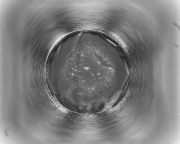 X0000093740948200710301102