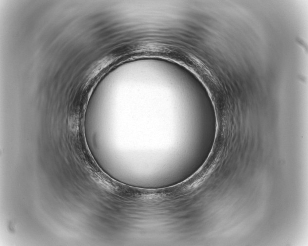 X0000093741017200710301100