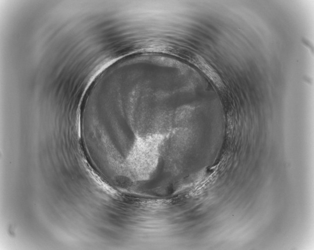 X0000093741036200710301100