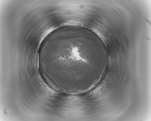 X0000093741123200710301059