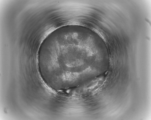 X0000093741133200710301059