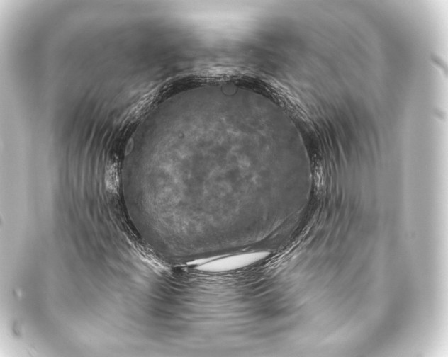 X0000093741204200710301057