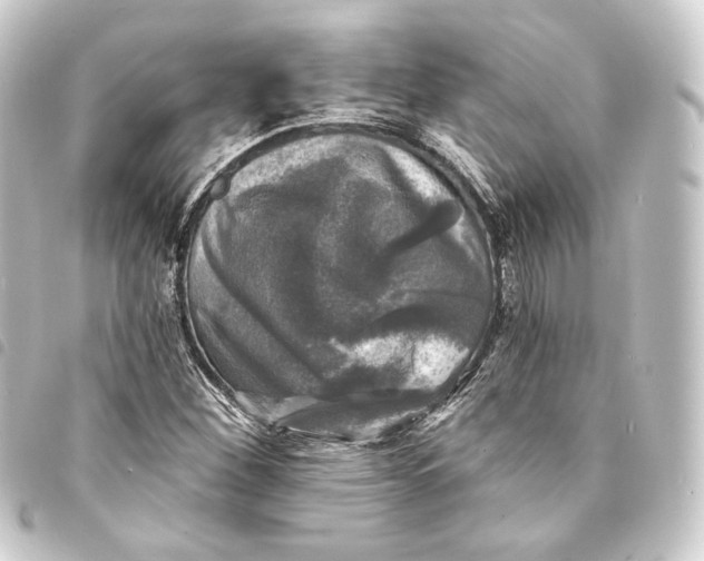 X0000093741260200710301057