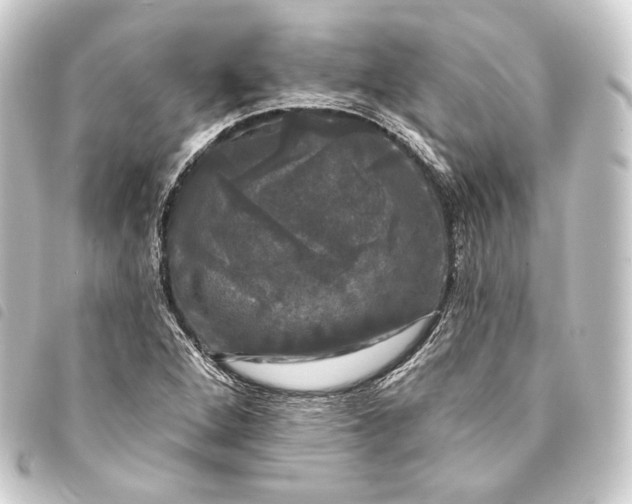 X0000093741264200710301057