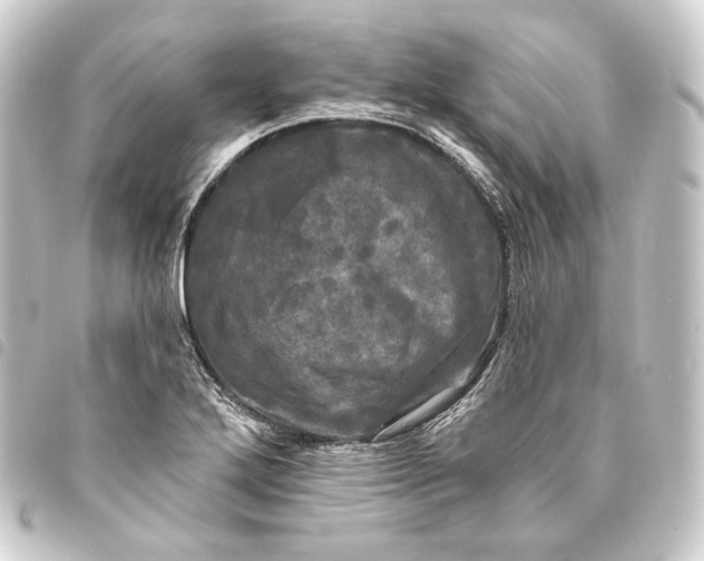 X0000093741272200710301057