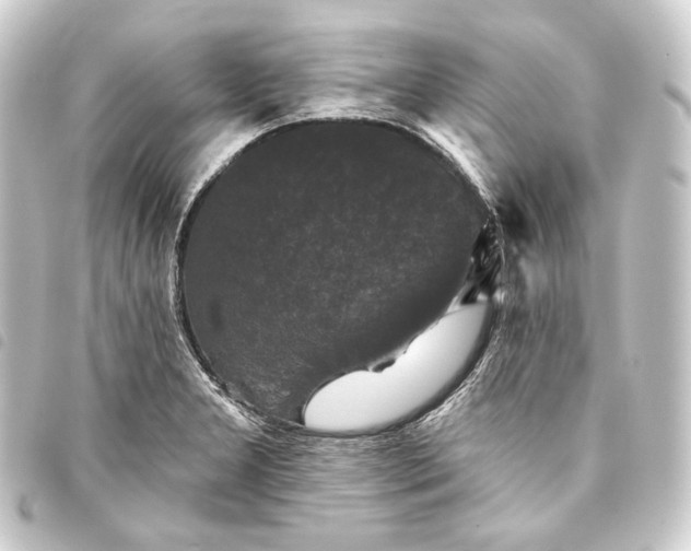 X0000093741277200710301057