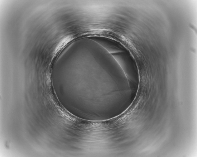 X0000093741362200710301056