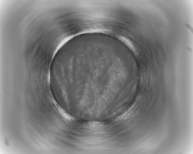 X0000093741420200710301055