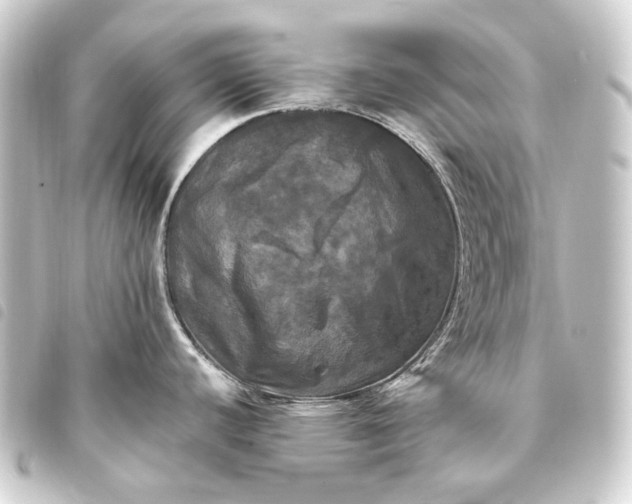 X0000093741440200710301055