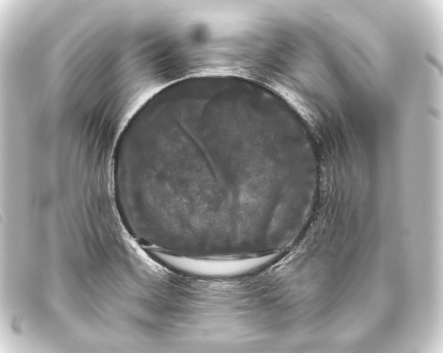 X0000093741468200710301054