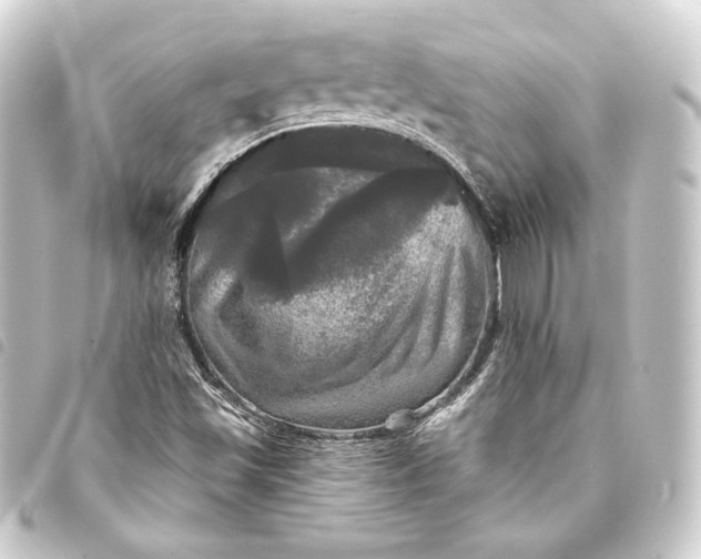 X0000093741501200710301054