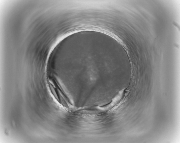 X0000093741536200710301054