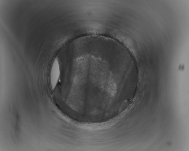 X0000093740017200711061035