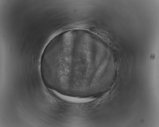 X0000093740148200711061032