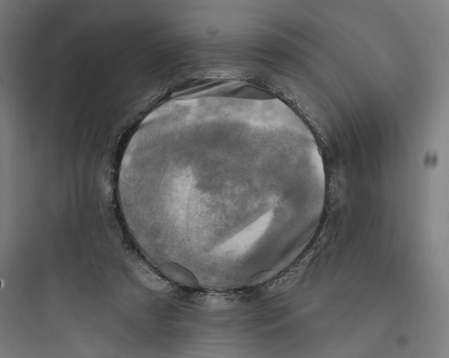 X0000093740305200711061030