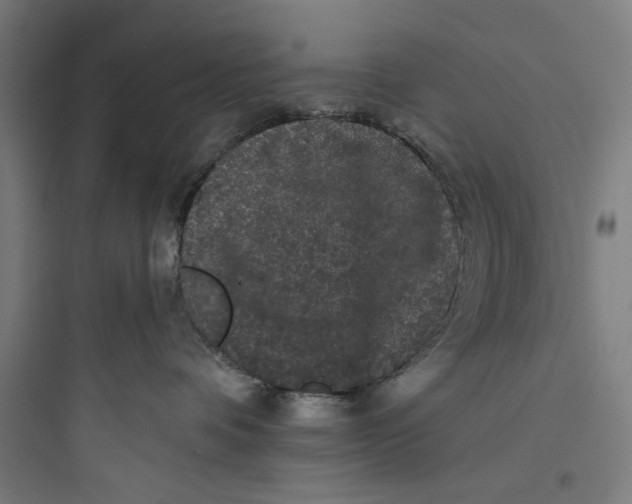 X0000093740336200711061030