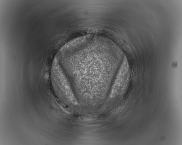 X0000093740962200711061020