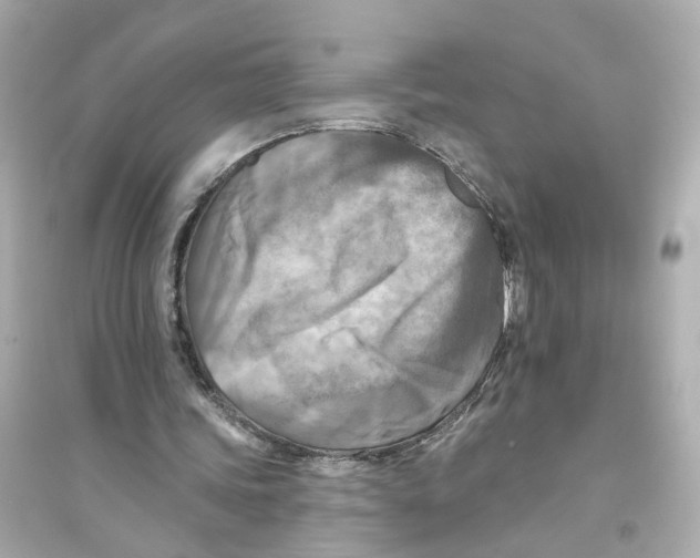 X0000093740339200711131107