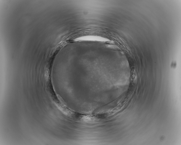 X0000093740568200711131104