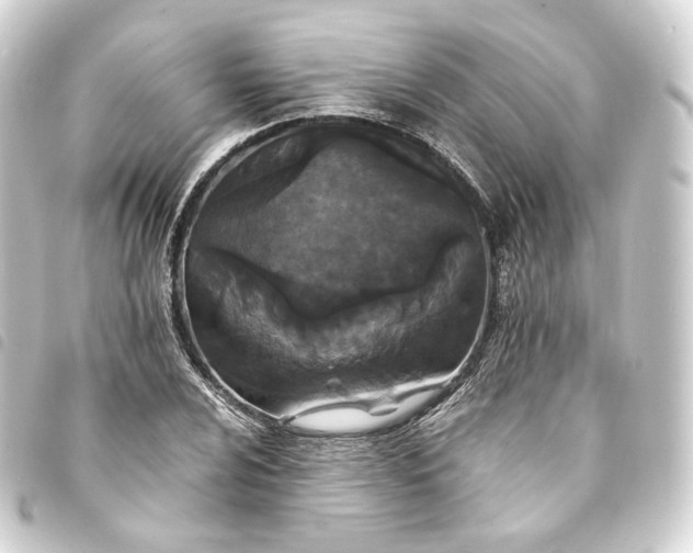 X0000093751024200710301120
