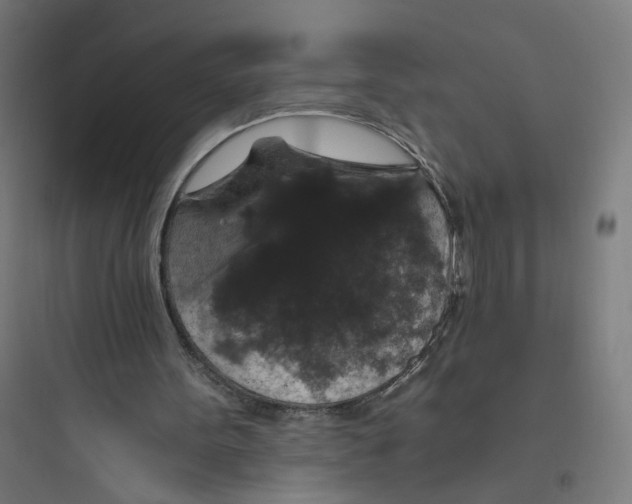 X0000093750099200711061057