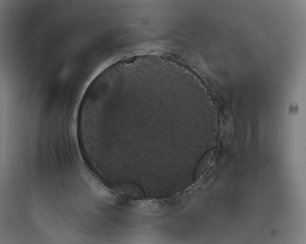 X0000093750100200711061057