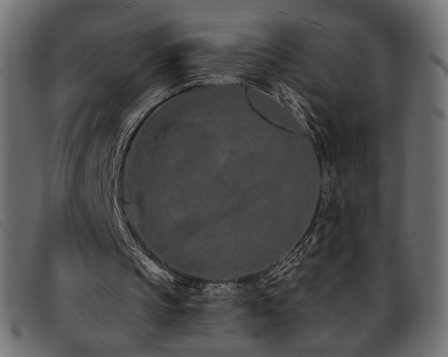X0000093760145200710161229