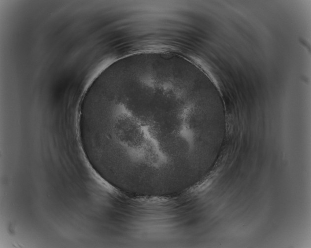 X0000093760851200710161221