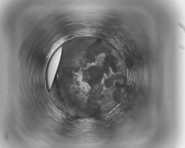 X0000093760099200710301153