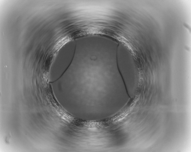 X0000093760785200710301143