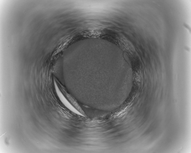 X0000093760818200710301142