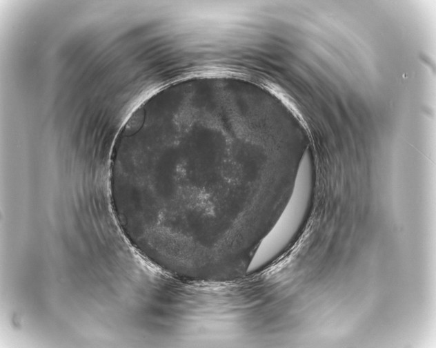 X0000093760853200710301143