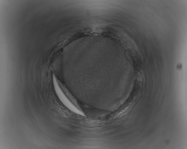 X0000093760818200711061109