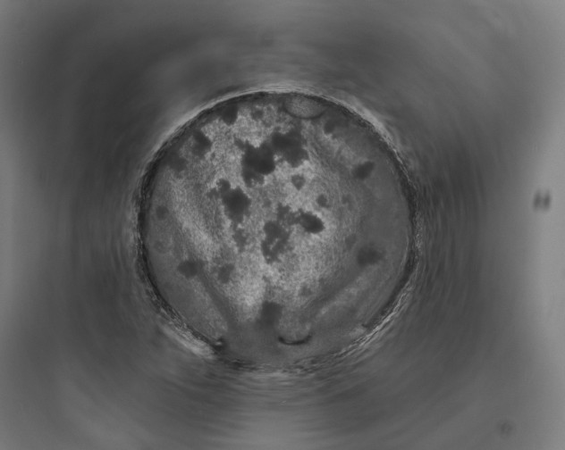 X0000093761263200711061102