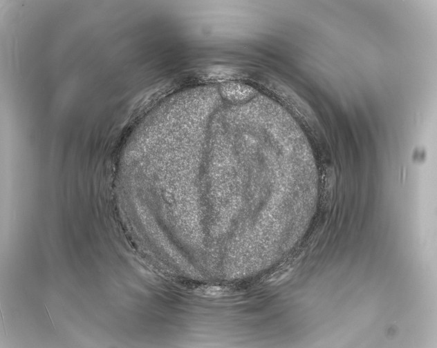 X0000093760361200711131154