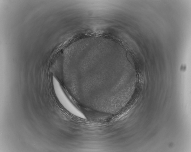 X0000093760818200711131146