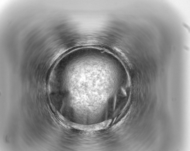 X0000093771457200710301155