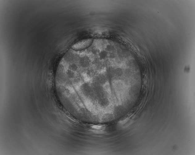 X0000093770659200711061135