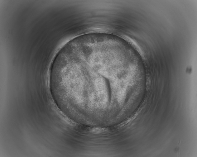 X0000093771419200711061123