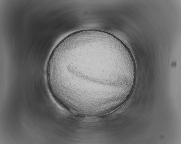 X0000093771440200711061124